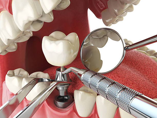 Best Teeth Whitening  in Lansing, MI